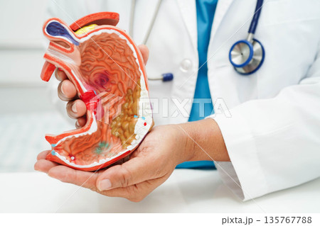 Stomach disease, doctor holding anatomy model for study diagnosis and treatment in hospital. 135767788