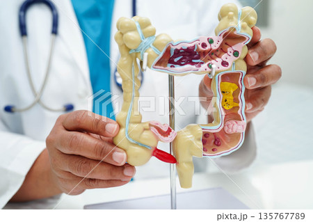 Intestine, doctor holding human anatomy model for study diagnosis and treatment in hospital. 135767789