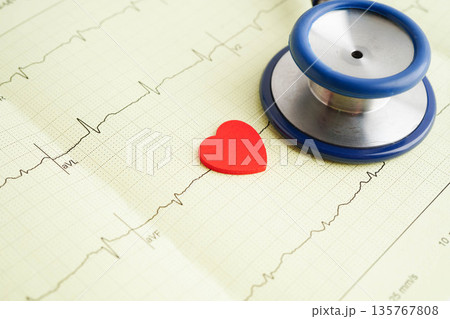Stethoscope on electrocardiogram ECG, heart wave, heart attack, cardiogram report. 135767808