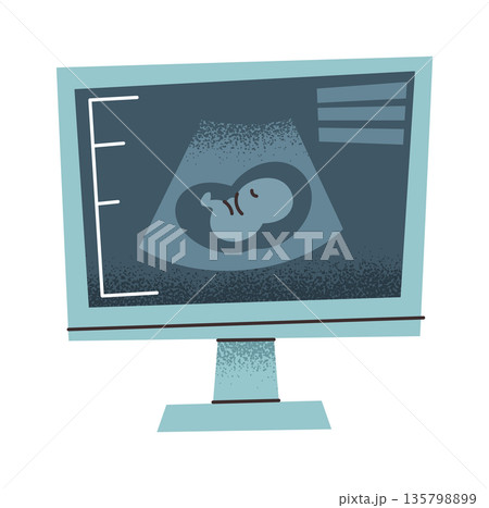 Baby in womb ultrasound screen Baby in womb ultrasound screen 135798899