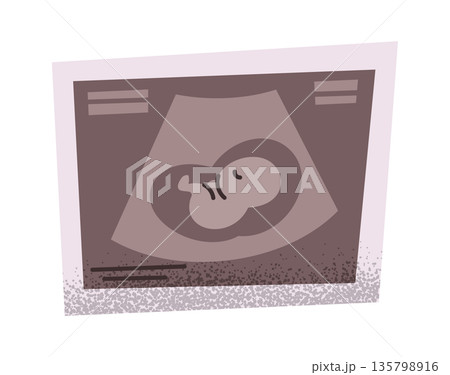 Baby fetus ultrasound scan image 135798916
