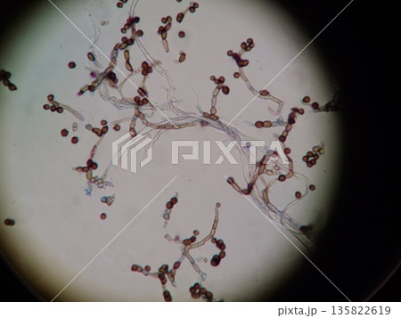 水回りや台所に存在するカビの顕微鏡写真 135822619