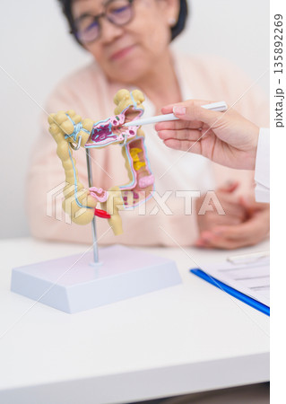 Elderly woman Patient consultation with doctor for Colon disease, Large Intestine, Colorectal cancer, Ulcerative colitis, Diverticulitis, Irritable bowel syndrome, Digestive system and Healthcare Elderly woman Patient consultation with doctor for Colon disease, Large Intestine, Colorectal cancer, Ulcerative colitis, Diverticulitis, Irritable bowel syndrome, Digestive system and Healthcare 135892269