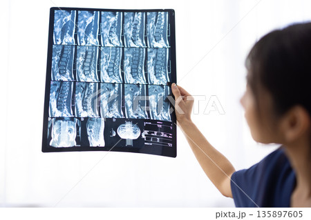 紺色の医療用スクラブを着た女性が持ったレントゲン写真 紺色の医療用スクラブを着た女性が持ったレントゲン写真 135897605