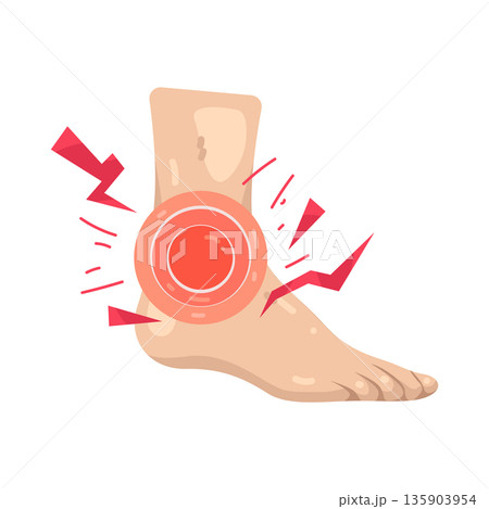 Illustration of ankle pain Illustration of ankle pain 135903954