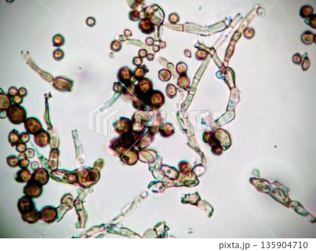 生えるとなかなか落ちない黒かび 135904710