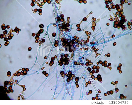 冷蔵庫などのパッキンに生える厄介なカビ 135904723