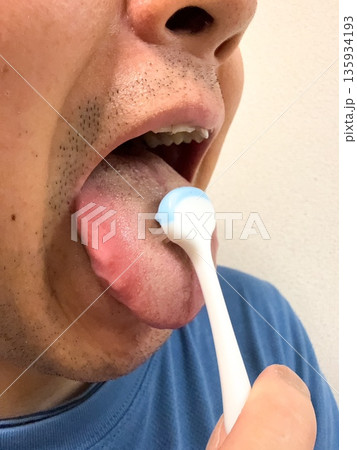 舌ブラシで舌苔をとる中年男性 135934193