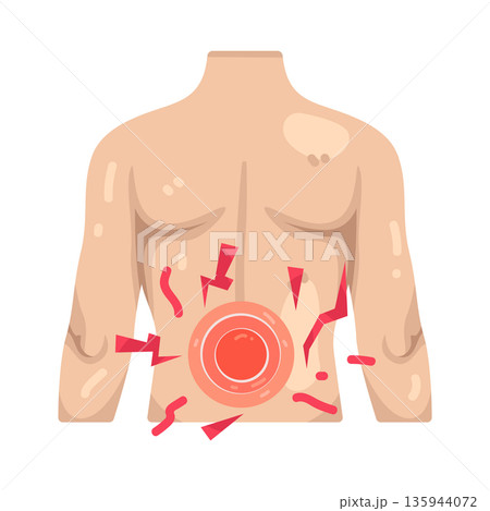 Illustration of Abdominal pain 135944072