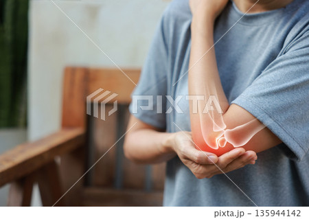 Close-up woman holding painful injured elbow with red inflamed spot and X-ray bone skeleton overlay. Medical concept of joint pain, fracture, arthritis, tendonitis, muscle injury, outdoor background. 135944142