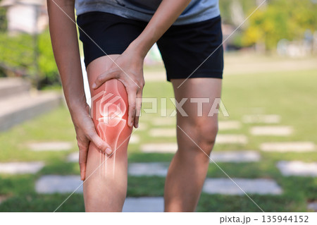 Close-up of hand holding painful injured knee with red inflamed spot and X-ray bone skeleton joint overlay. Medical concept of fracture, arthritis, tendonitis, or muscle ache in outdoor background. 135944152