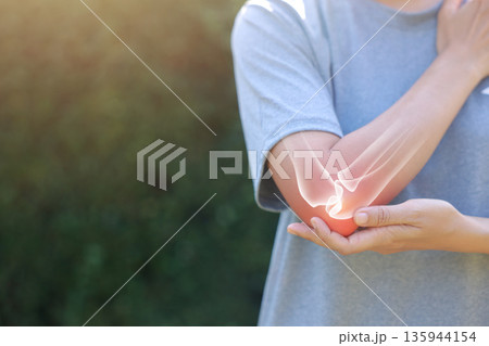 Close-up woman holding painful injured elbow with red inflamed spot and X-ray bone skeleton overlay. Medical concept of joint pain, fracture, arthritis, tendonitis, muscle injury, outdoor background. 135944154