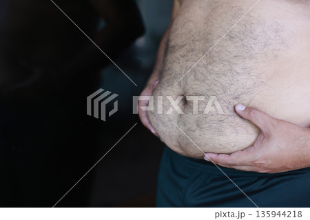 Close-up of overweight man hand holding excessive belly fat. Concept of obesity, unhealthy lifestyle, weight loss, body mass index, and metabolism problem. Male torso with hairy skin background. 135944218