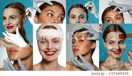 Aesthetic medicine consultation with female portraits. Collage of 2 models Aesthetic medicine consultation with female portraits. Collage of 2 models 135949456