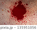 Blood spill on operating room floor during surgery 135951056