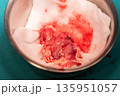 Brain Tumor Surgical Specimen 135951057
