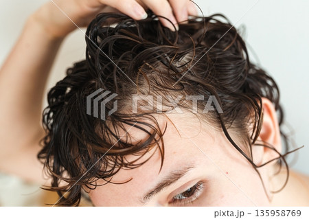 early baldness in women 135958769