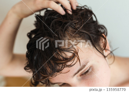early baldness in women 135958770