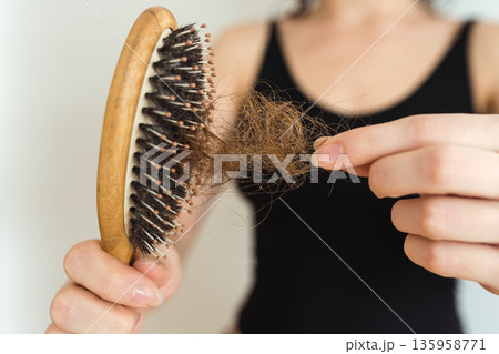 early baldness in women early baldness in women 135958771