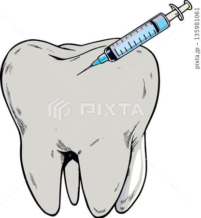 Dentist injecting anesthesia into tooth using syringe for dental treatment 135981061
