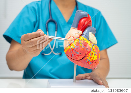 Cardiovascular disease CVD, doctor with heart human model. Cardiovascular disease CVD, doctor with heart human model. 135983607