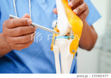 Asian doctor holding spinal nerve and bone model, Lumbar spine displaced herniated disc fragment for treatment medical in the orthopedic department. 135992477