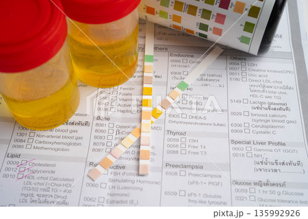 Urinalysis, urine cup with reagent strip pH paper test and comparison chart in laboratory. Urinalysis, urine cup with reagent strip pH paper test and comparison chart in laboratory. 135992926