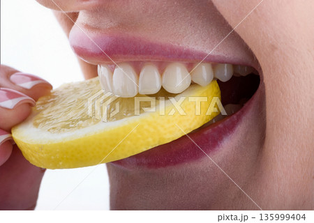 Close up of female teeth biting lemon slice showing ceramic veneers and natural dental care concept Close up of female teeth biting lemon slice showing ceramic veneers and natural dental care concept 135999404