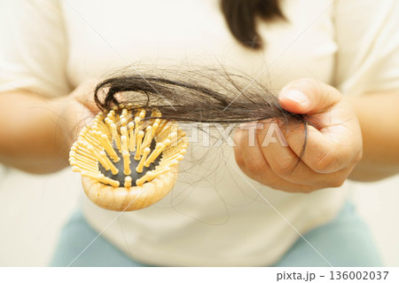 Asian woman have problem with long hair loss attach to comb brush. Asian woman have problem with long hair loss attach to comb brush. 136002037