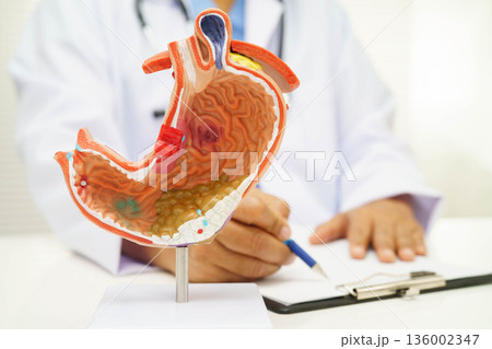 Stomach disease, doctor holding anatomy model for study diagnosis and treatment in hospital. Stomach disease, doctor holding anatomy model for study diagnosis and treatment in hospital. 136002347