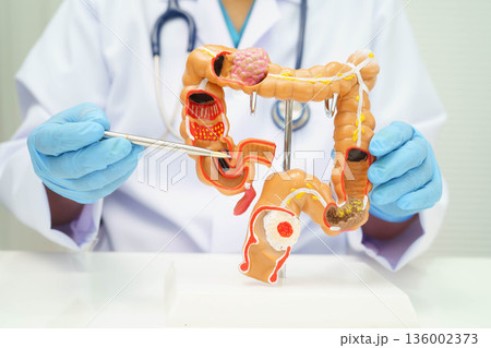 Intestine, doctor holding human anatomy model for study diagnosis and treatment in hospital. 136002373