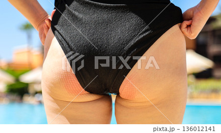 Red marks on the buttocks from sitting on a chair for a long time 136012141