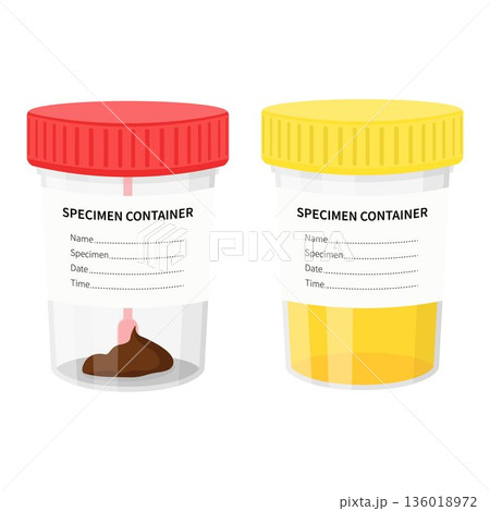 Two plastic jars with samples of urine and stools. Medical laboratory tests. illustration in flat style Two plastic jars with samples of urine and stools. Medical laboratory tests. illustration in flat style 136018972