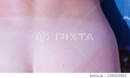 Woman body after taking off bikini with visible tan line from wearing panties Woman body after taking off bikini with visible tan line from wearing panties 136020901