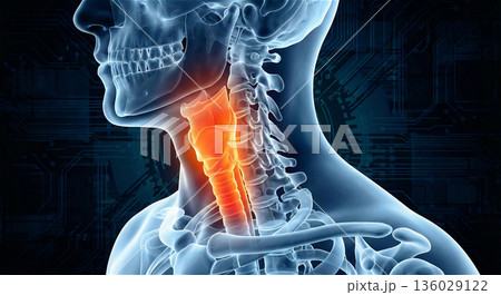 喉の痛みと炎症のイラスト 扁桃腺 声帯 食道 骨格レントゲン 3DCG 広告素材 136029122