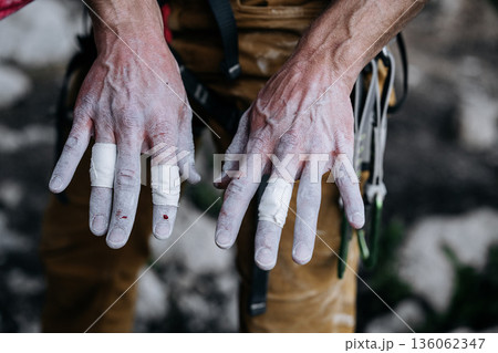 Chalk Covered Fingers Of Rock Climber After Difficult Route: Taped Fingertips, Worn Skin, And Small Traces Of Blood Showing Physical Strain In Close Up Detail 136062347