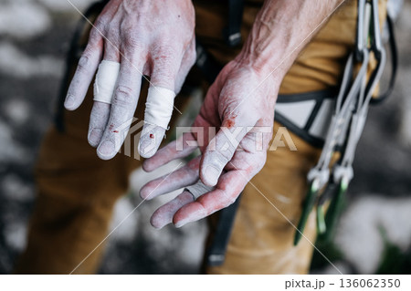 Chalk Covered Fingers Of Rock Climber After Difficult Route: Taped Fingertips, Worn Skin, And Small Traces Of Blood Showing Physical Strain In Close Up Detail 136062350