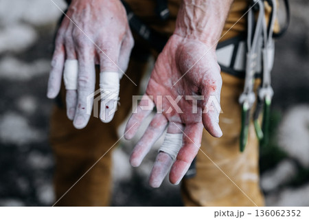 Chalk Covered Fingers Of Rock Climber After Difficult Route: Taped Fingertips, Worn Skin, And Small Traces Of Blood Showing Physical Strain In Close Up Detail 136062352