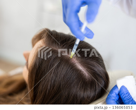 Hands of trichologist performing injections into scalp to female patient Hands of trichologist performing injections into scalp to female patient 136065853