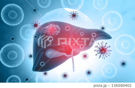 Viral infection on human liver Viral infection on human liver 136080402