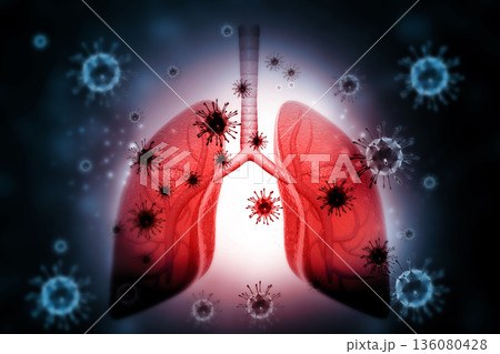 Lungs disease with virus ,bacteria 136080428