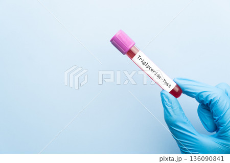 Blood sample tube with triglyceride cholesterol test label on medical laboratory technologist hands over blue background. Blood sample tube with triglyceride cholesterol test label on medical laboratory technologist hands over blue background. 136090841