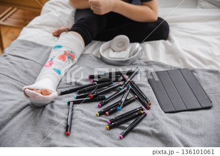 Woman hands drawing on broken leg cast. Unrecognizable girl draws with felt tip pens on orthopedic cast. Bored girl with broken leg playing at home during rehabilitation. Accident injury fracture 136101061