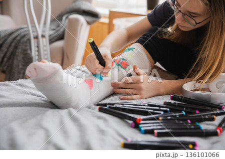 Young teenage girl with broken leg sitting on bed draws with felt tip pens on orthopedic cast. Bored girl with broken leg playing at home during rehabilitation. Accident injury fracture treatment 136101066