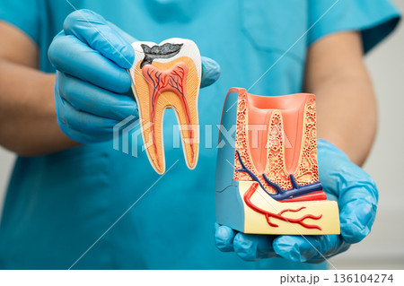 Asian dentist holding dental implant, artificial tooth roots into jaw, root canal of dental treatment, gum disease, teeth model for dentist. 136104274