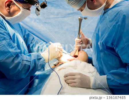 Surgery to remove the breast and replace it with an implant. 136107485