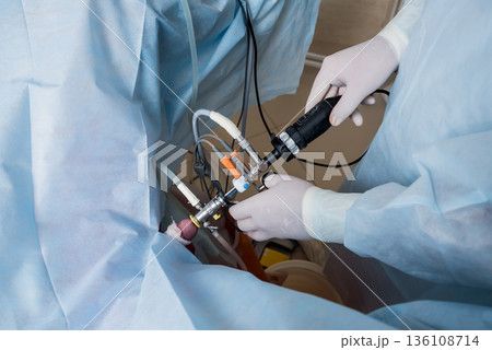 Process of urological surgery operation using laparoscopic equipment. Process of urological surgery operation using laparoscopic equipment. 136108714