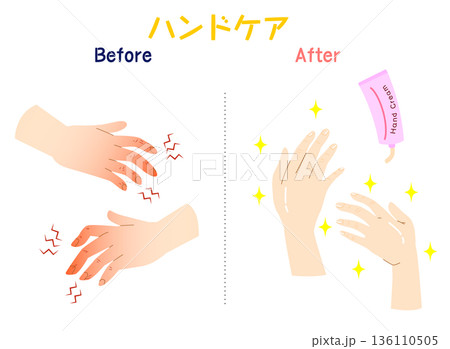 手荒れのビフォーアフター　ハンドクリームで改善する手のイラスト 136110505