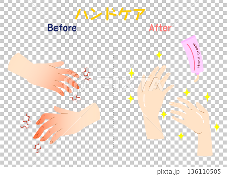 手荒れのビフォーアフター　ハンドクリームで改善する手のイラスト 136110505