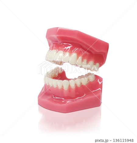 インビザライン マウスピース矯正 イラスト リアル 136115948
